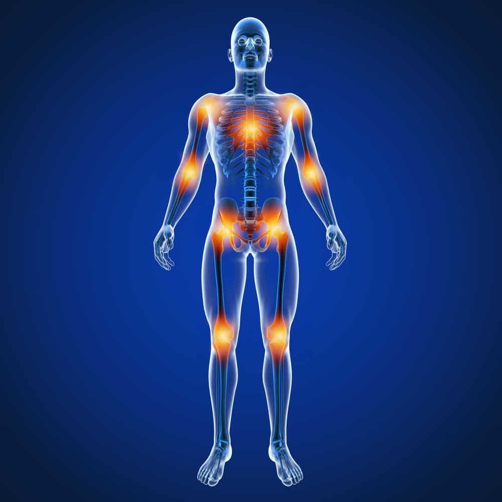 Fibromiyalji Sendromu