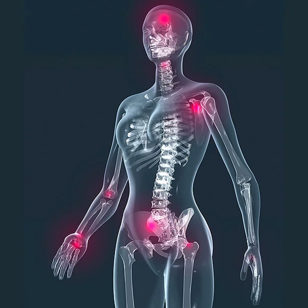 Diğer İltihaplı Romatizmalar